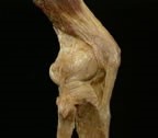 Image of a knee joint
